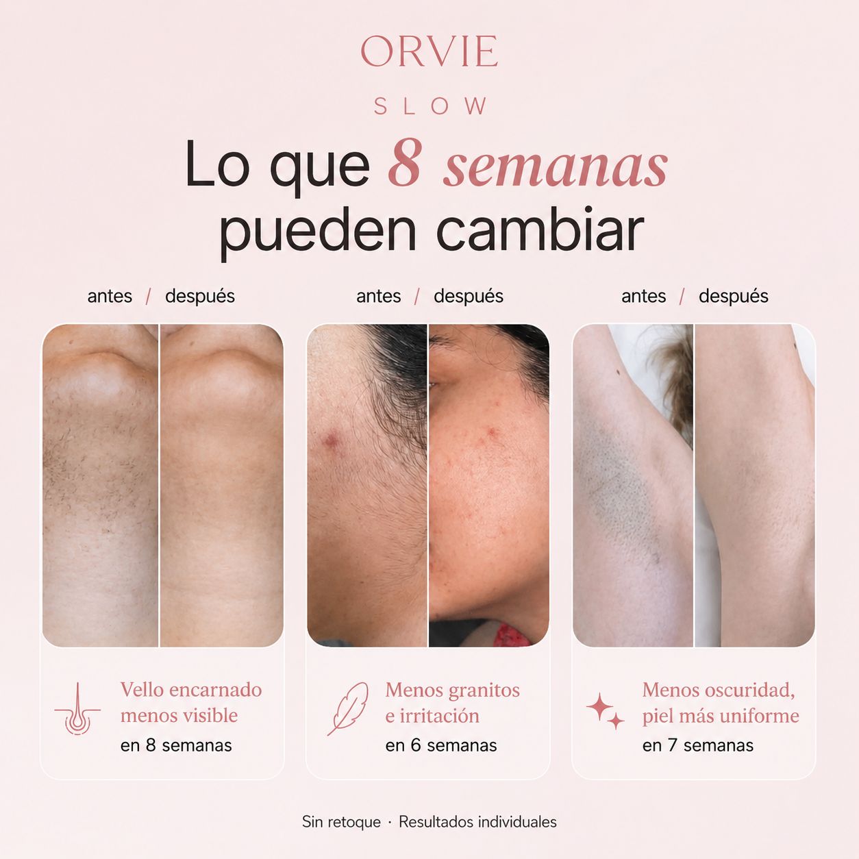 Sérum Inhibidor del Vello
