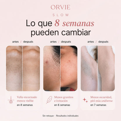 Sérum Inhibidor del Vello